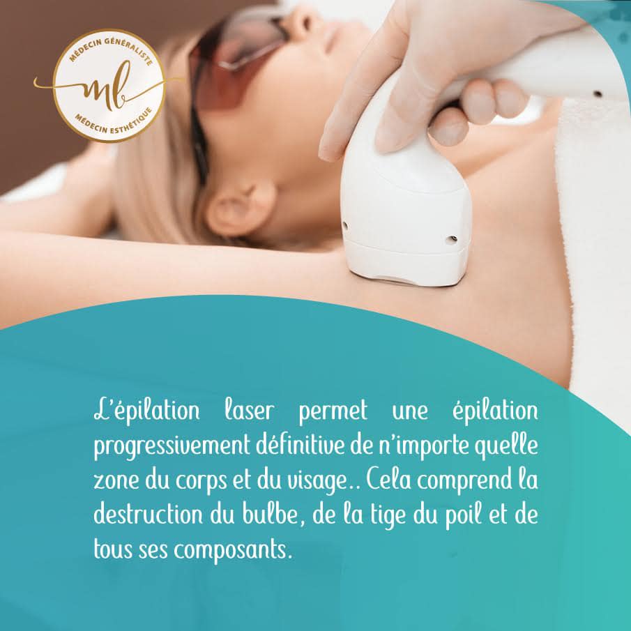 L'épilation laser
