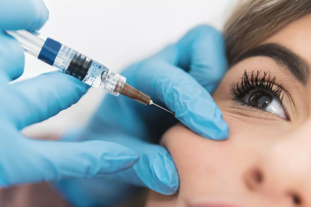 Injection d'acide hyaluronique